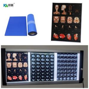 China Blue Base Medical Inkjet X Ray Film For Digital Image 280gsm For 14x17inch Color Image on sale