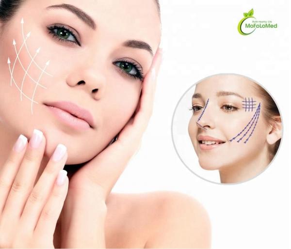 Cheap Korean Polydioxanone Face lift Products for sale