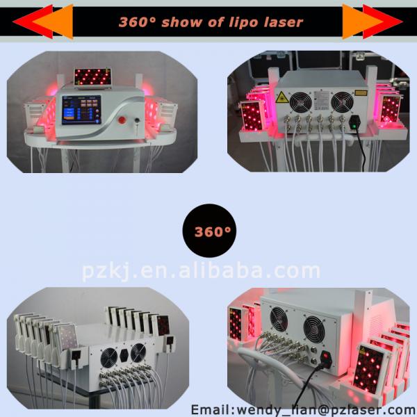 360 show of lipo laser.png