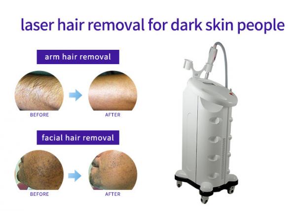 Cheap Nd Yag Laser Depilation Machine , Long Pulsed Permanent Hair Removal Machine for sale