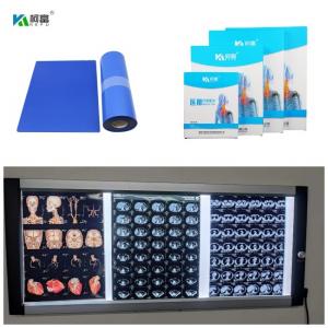 China Medical Inkjet Blue Base X Ray Film Digital Image With 210um For 14x17inch on sale