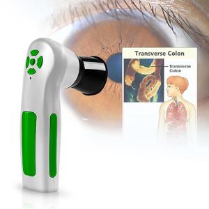 China High Resolution CCD USB Iriscope Diagnostic Eye Camera With 12MP HD 30x Iris Lens on sale