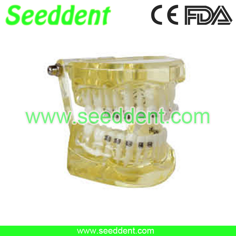 Best Orthodontic model with 4 kind of bracket wholesale