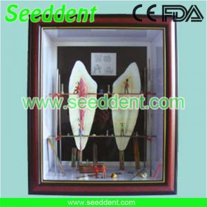 Best Shadow box tooth with nerve wholesale