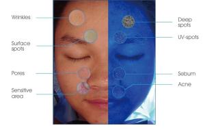 Best Support External Printer Skin Analysis System With Android 8.1 Operating Platform wholesale