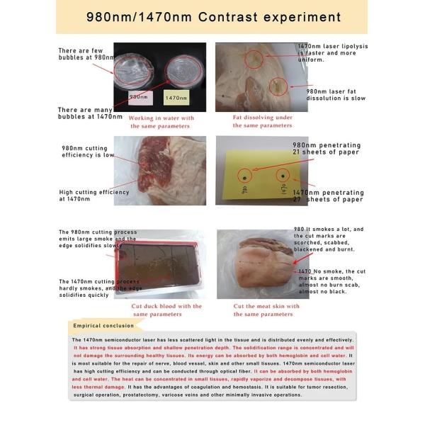 Endolift Laser Machine With 1470nm Powerful Energy For Face Lift Double Chin Shaping And Fat Cellulite Reduction