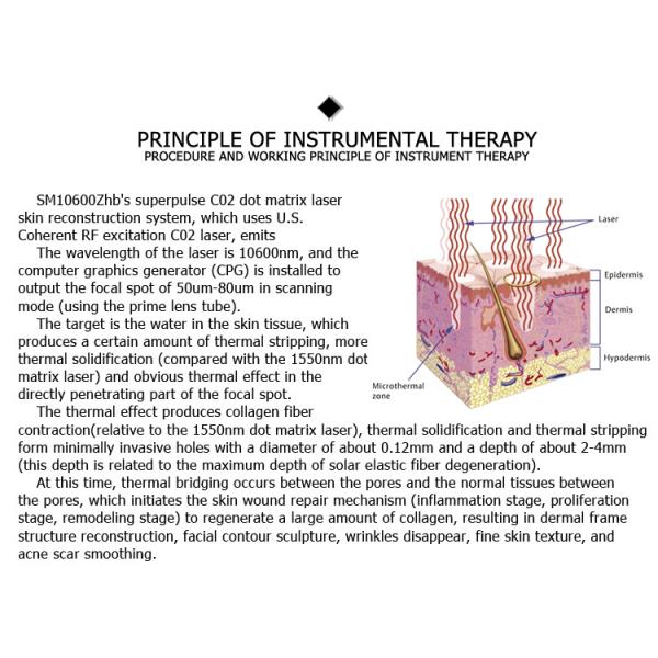 2021 new design 10.4 Inch true color LCD touch screen co2 fractional laser vaginal tightening device