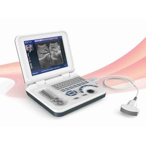 Notebook Veterinary Ultrasound Machines Digital Ultrasound Scanner Rectal Probe