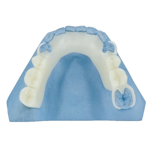 OEM PFM Dental Bridge 3D Digital Intraoral Scanning Imaging System