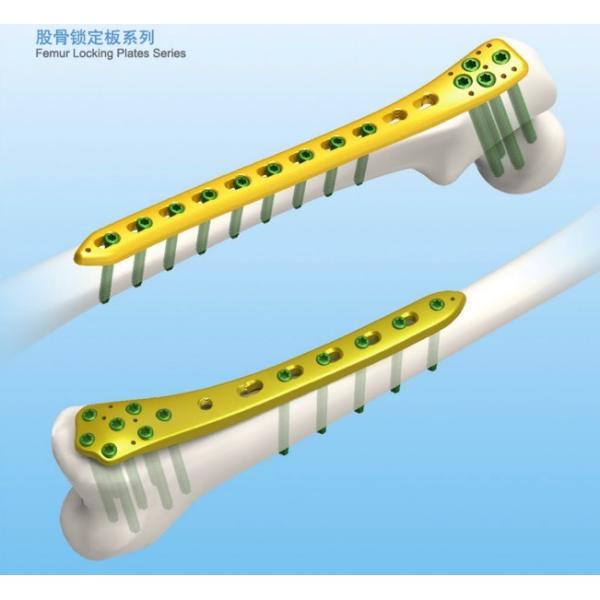 5.6mm Titanium Proximal Femur Orthopedic Locking Plate Type I