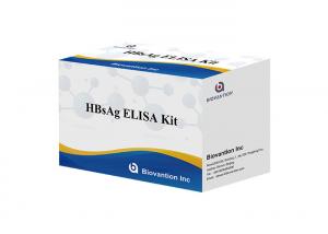 China Infectious Disease HBsAg Elisa Kit Hepatitis B Surface Antigen Elisa Test on sale