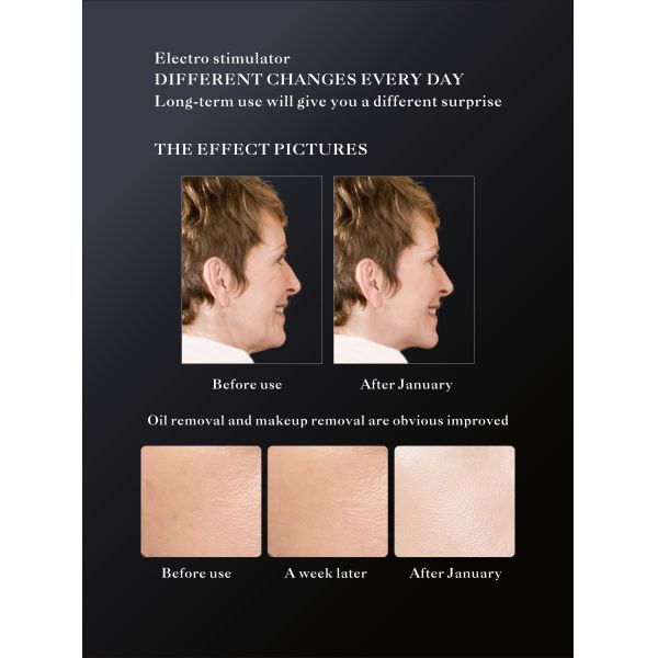 Moisturizing Wrinkle Remove Superconducting Water Light Base Ion Machine