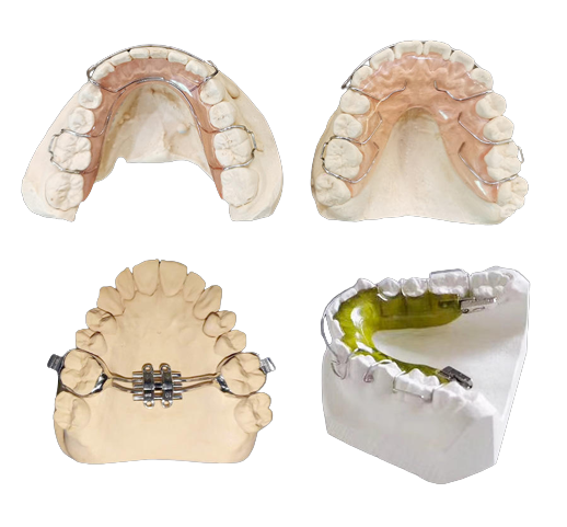 Dental Functional Appliance, High Precision, Smooth Surface, Comfortable To Wear
