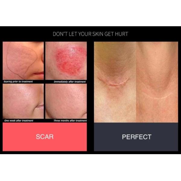 Radio Frequency Effective Body Skin Tightening Machine With Dual Frequency