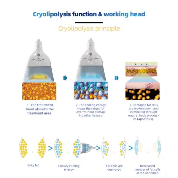 Portable Painless Cryolipolysis Slimming Machine Freezing Fat Double-chin Removal Machine