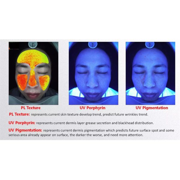 Portable Ai 20 Million Facial Scanner Skin Analyzer 3d Uv Magic Mirror