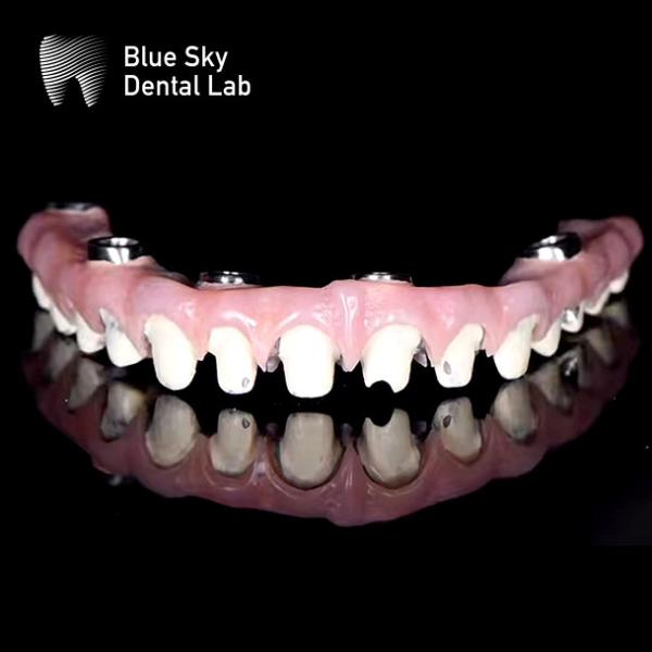 Universal Customized Malo Bridge With Silver / Gold Anodized And Pure Titanium