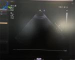 S5-1 Linear Array Ultrasound Transducer Probe Crystal Array Replacement