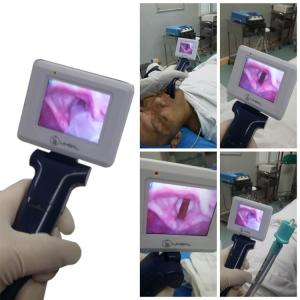 Best Operating Portable Video Laryngoscope Using In Routine Endotracheal Intubation wholesale