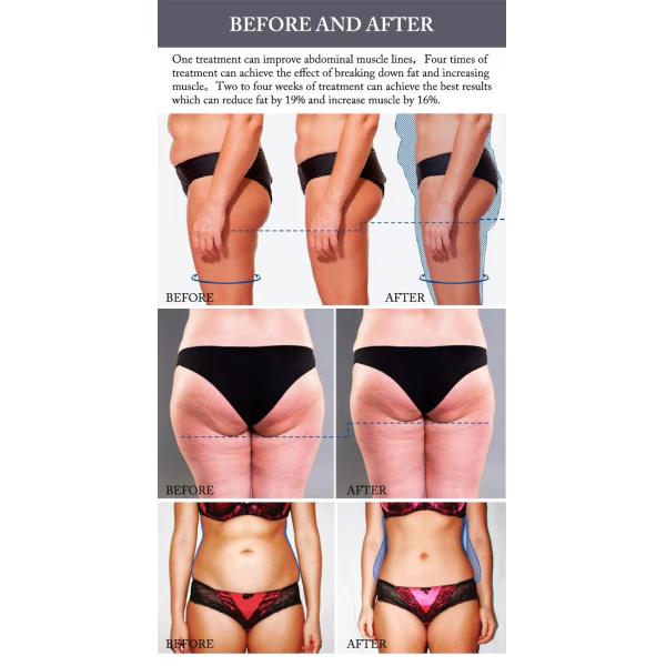 COWEROAY EMS Muscle Stimulator Machine Electromagnetic Sculpting Machine