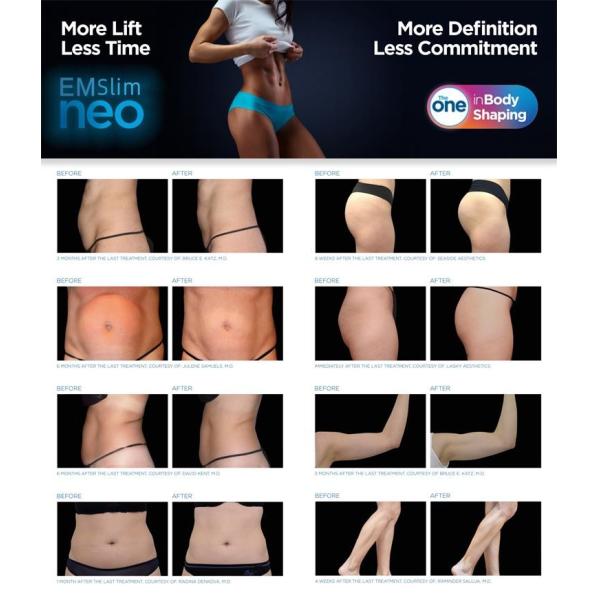 110V-220V EMS Muscle Stimulator Machine , 2 Handles EMS Machine For Weight Loss