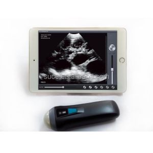 Best Laptop color Doppler ultrasound system Uprobe-1 wholesale