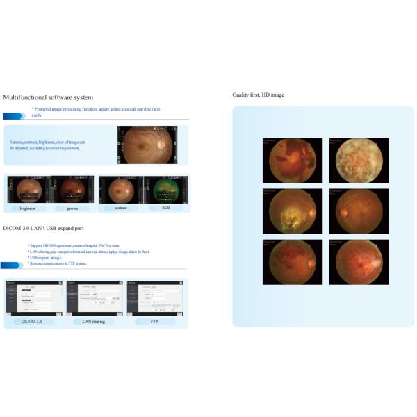13mm WD Non Mydriatic Fundus Camera 50° FOV Auto/Manual Focus