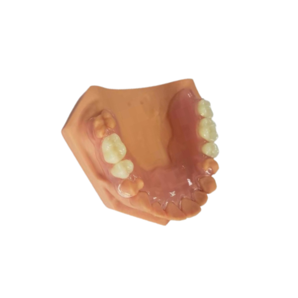 3D Printed Dentures For Dental Labs Based On Digital Data