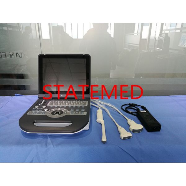 Full Digital Vascular Color Doppler Ultrasound Scanner Convex Arra Canning Mode