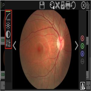 High Resolution Digital Fundus Camera Red Free Retinal Imaging