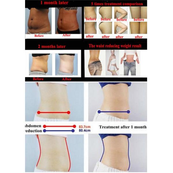 Multifunction 650nm Lipo Laser Body Shaper Machine Non - Ablative Rejuvenation