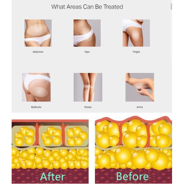 Electromagnetic ESWT Therapy Machine With 8 Inch Touch Screen