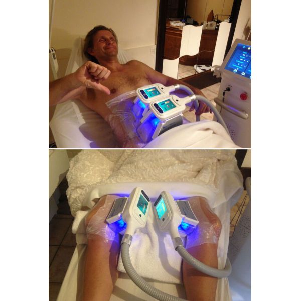 the different color you can choose cryotherapy slimming machine 4-5cm fat lost after 1 treatment