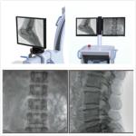 Digital C Arm Machine Wireless Dynamic Flat Panel Detector FPD C-Arm – PLX118F