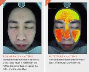 China Handheld Wireless Wifi 3d Skin Analysis Machine Digital With Video Microscope on sale