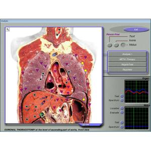 OEM / ODM 3d Nls Health Analyzer , 3d Mra Scaner Machine