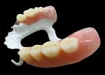 Customized Partial Removable Denture with High-Performance Polymer (HPP)