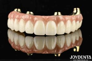Best Functionality Ti-Bar Compatible With Natural Teeth And Gums Restores Chewing Function wholesale