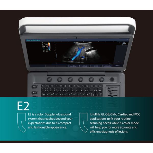 Sonoscape E2V E2 Veterinary Scanner Portable Color Doppler Ultrasound Machine